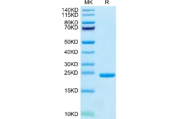 Cytokeratin 19 Protein (AA 310-399) (His tag)