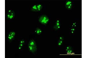 Immunofluorescence of purified MaxPab antibody to C14orf169 on HeLa cell.