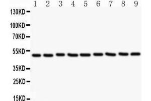 Western Blotting (WB) image for anti-C-Src tyrosine Kinase (CSK) (AA 2-204) antibody (ABIN3042764) (CSK Antikörper  (AA 2-204))