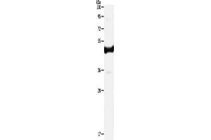 Western Blotting (WB) image for anti-Interleukin 11 Receptor, alpha (IL11RA) antibody (ABIN2421099) (IL11RA Antikörper)