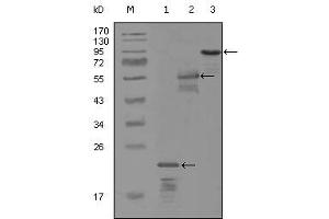Western blot analysis using ERBB3 mouse mAb against truncated Trx-ERBB3 recombinant protein (1), MBP-ERBB3 (aa1175-1275) recombinant protein (2) and truncated ERBB3(aa665-1342)-hIgGFc transfected CH0-K1 cell lysate (3). (ERBB3 Antikörper)