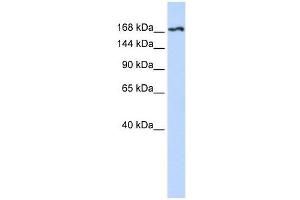 Western Blot showing KDR antibody used at a concentration of 1-2 ug/ml to detect its target protein. (VEGFR2/CD309 Antikörper  (N-Term))