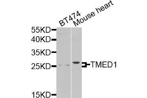 Western blot analysis of extracts of various cells, using TMED1 antibody. (TMED1 Antikörper)