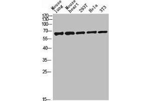 Western blot analysis of mouse-lung mouse-lung lysate, antibody was diluted at 2000. (C-Type Lectin Domain Family 4, Member M (CLEC4M) (AA 271-320) Antikörper)