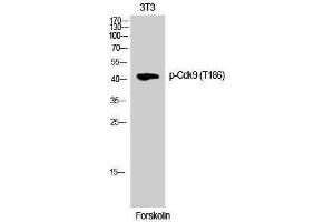 Western Blotting (WB) image for anti-Cyclin-Dependent Kinase 9 (CDK9) (pThr186) antibody (ABIN3179547) (CDK9 Antikörper  (pThr186))