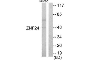 Western Blotting (WB) image for anti-Zinc Finger Protein 24 (ZNF24) (N-Term) antibody (ABIN1849195) (ZNF24 Antikörper  (N-Term))