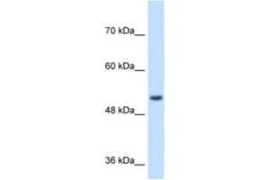 Western Blotting (WB) image for anti-Signal Peptide Peptidase-Like 2B (SPPL2B) antibody (ABIN2464000) (SPPL2B Antikörper)