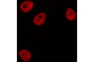 ABIN6276831 staining  Hela cells by IF/ICC. (CTBP1 Antikörper  (Internal Region))