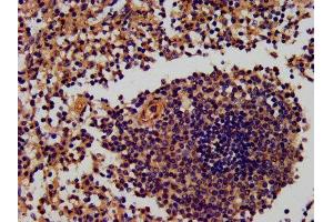 IHC image of ABIN7168264 diluted at 1:600 and staining in paraffin-embedded human spleen tissue performed on a Leica BondTM system.