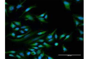 Immunofluorescence of purified MaxPab antibody to PPP1R1C on HeLa cell.