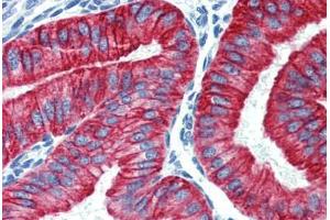 Uterus, Human: Formalin-Fixed, Paraffin-Embedded (FFPE) (Cytokeratin 19 Antikörper  (C-Term))