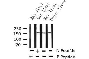 Western blot analysis of Phospho-EGFR (Tyr1016) expression in various lysates (EGFR Antikörper  (pTyr1016))