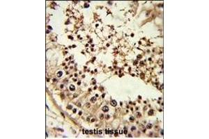 Formalin-fixed and paraffin-embedded human testis tissue reacted with TBP Antibody (Center), which was peroxidase-conjugated to the secondary antibody, followed by DAB staining. (TBP Antikörper  (AA 210-239))