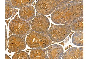 ABIN7093239 and ABIN7097252 at 1/100 staining Mouse testis tissue by IHC-P.