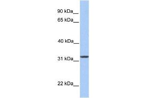 WB Suggested Anti-SIGLEC12 Antibody Titration:  0. (SIGLEC12 Antikörper  (N-Term))