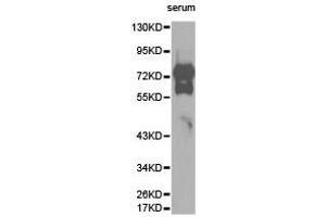 Western Blotting (WB) image for anti-Vitronectin (VTN) antibody (ABIN1875340) (Vitronectin Antikörper)