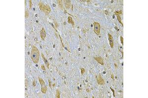 Immunohistochemistry of paraffin-embedded mouse brain using ITGA2 Antibody. (ITGA2 Antikörper)