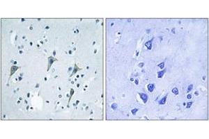Immunohistochemistry analysis of paraffin-embedded human brain tissue, using GPR85 Antibody. (GPR85 Antikörper  (AA 181-230))