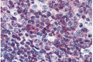 Human Tonsil (formalin-fixed, paraffin-embedded) stained with CEBPB antibody ABIN364320 at 10 ug/ml followed by biotinylated anti-mouse IgG secondary antibody ABIN481714, alkaline phosphatase-streptavidin and chromogen. (CEBPB Antikörper)