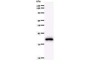 Western Blotting (WB) image for anti-MYC Associated Factor X (MAX) antibody (ABIN932461) (MAX Antikörper)
