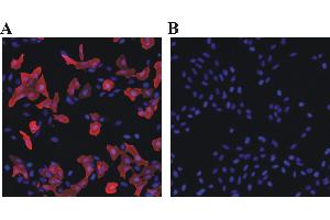 Immunofluorescent analysis for testing of Rabbit anti-chicken polyclonal antibody DyLight 549 conjugate as secondary antibody. (Kaninchen anti-Huhn IgY Antikörper (DyLight 549))