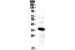 Western blot analysis of IGFBP2 using anti-IGFBP2 antibody .