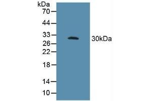 Detection of FcgR3A in Porcine Spleen Tissue using Polyclonal Antibody to Fc Fragment Of IgG Low Affinity IIIa Receptor (FcgR3A) (FCGR3A Antikörper  (AA 26-108))