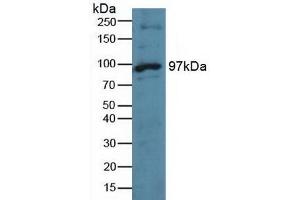 Detection of TTK in Human Hela Cells using Polyclonal Antibody to TTK Protein Kinase (TTK) (Mps1 Antikörper  (AA 532-786))