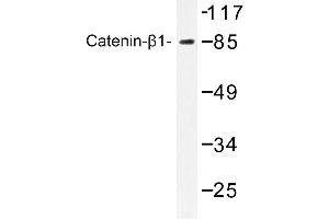 Image no. 1 for anti-Catenin (Cadherin-Associated Protein), beta 1, 88kDa (CTNNB1) antibody (ABIN272182) (CTNNB1 Antikörper)