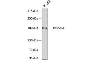 Western blot analysis of extracts of K-562 cells using DROSHA Polyclonal Antibody at dilution of 1:1000. (DROSHA Antikörper)