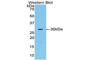 Western Blotting (WB) image for anti-Acrosin (ACR) (AA 43-291) antibody (ABIN1857876) (Acrosin Antikörper  (AA 43-291))