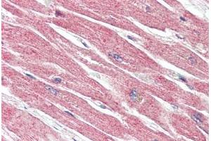 Human Heart (formalin-fixed, paraffin-embedded) stained with BECN1 antibody ABIN461895 at 5 ug/ml followed by biotinylated goat anti-rabbit IgG secondary antibody ABIN481713, alkaline phosphatase-streptavidin and chromogen. (Beclin 1 Antikörper  (N-Term))