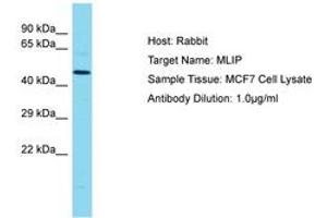 Image no. 1 for anti-Muscular LMNA-Interacting Protein (MLIP) (AA 194-243) antibody (ABIN6750721) (MLIP Antikörper  (AA 194-243))