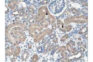 SSR1 antibody was used for immunohistochemistry at a concentration of 4-8 ug/ml. (SSR1 Antikörper)