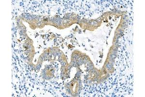 IHC analysis of Cytokeratin 8 using anti-Cytokeratin 8 antibody (ABIN6719478). (KRT8 Antikörper  (AA 107-325))