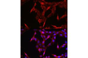 Immunofluorescence analysis of NIH/3T3 cells using ST Rabbit pAb (ABIN6128541, ABIN6148581, ABIN6148582 and ABIN6213980) at dilution of 1:200 (40x lens). (STAT6 Antikörper  (AA 1-180))