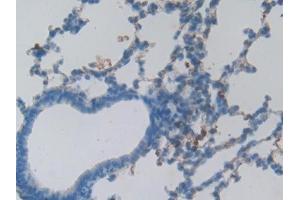 Immunohistochemistry (IHC) image for anti-HSPA Binding Protein, Cytoplasmic Cochaperone 1 (HSPBP1) (AA 198-352) antibody (ABIN7437581)