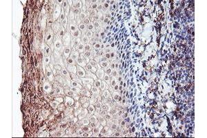 Image no. 5 for anti-Retinaldehyde Binding Protein 1 (RLBP1) antibody (ABIN1497622) (RLBP1 Antikörper)