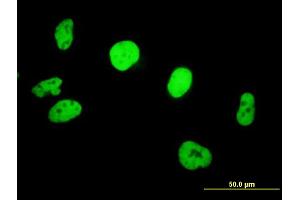 Immunofluorescence of purified MaxPab antibody to SMARCB1 on HeLa cell.