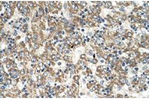 Immunohistochemical staining (Formalin-fixed paraffin-embedded sections) of human liver with GOT2 polyclonal antibody  at 4-8 ug/mL working concentration. (GOT2 Antikörper  (C-Term))
