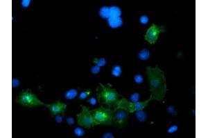 Anti-LRRC25 mouse monoclonal antibody (ABIN2455880) immunofluorescent staining of COS7 cells transiently transfected by pCMV6-ENTRY LRRC25 (RC209911). (LRRC25 Antikörper)