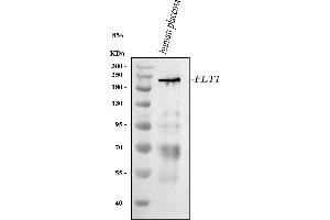 Western blot analysis of VEGFR-1/FLT1 using anti-VEGFR-1/FLT1 antibody (ABIN7601031).