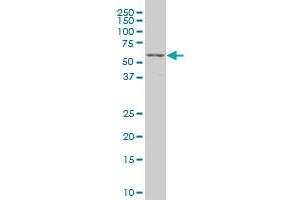 Western Blotting (WB) image for anti-Transcription Factor 7-Like 2 (T-Cell Specific, HMG-Box) (TCF7L2) (AA 490-596) antibody (ABIN520778)