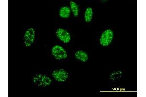 Immunofluorescence of purified MaxPab antibody to ELK4 on HeLa cell.