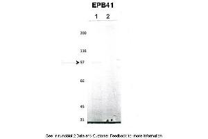 Lanes:   1. (EPB41 Antikörper  (N-Term))