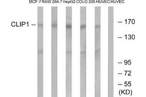 Western Blotting (WB) image for anti-CAP-GLY Domain Containing Linker Protein 1 (CLIP1) (C-Term) antibody (ABIN1850985) (CLIP1 Antikörper  (C-Term))