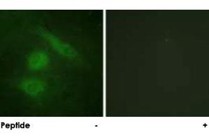 Immunofluorescence analysis of HeLa cells, using IRF3 polyclonal antibody . (IRF3 Antikörper)