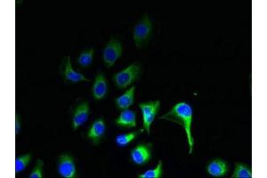 Immunofluorescent analysis of A549 cells using ABIN7164574 at dilution of 1:100 and Alexa Fluor 488-congugated AffiniPure Goat Anti-Rabbit IgG(H+L) (ZDHHC2 Antikörper  (AA 75-130))
