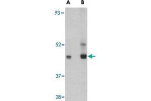 Western blot analysis of PAFAH1B1 in HeLa cell lysate with PAFAH1B1 polyclonal antibody  at (A) 0. (PAFAH1B1 Antikörper  (C-Term))