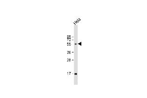 Anti-FUT6 Antibody (Center) at 1:1000 dilution + Hela whole cell lysate Lysates/proteins at 20 μg per lane. (FUT6 Antikörper  (AA 102-130))